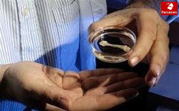 موفقیت محققان در پرورش استخوان از چربی