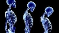 کاهش قد را جدی بگیرید،یک نشانه است! 