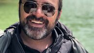 چهره بی مو آقای بازیگر + عکس