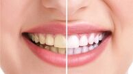 راه‌های حفظ سلامت دندان و سفیدکردن آن از منظر طب سنتی