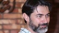 چهره جدی و متفاوت پارسا پیروزفر در «بی‌حسی موضعی» + عکس