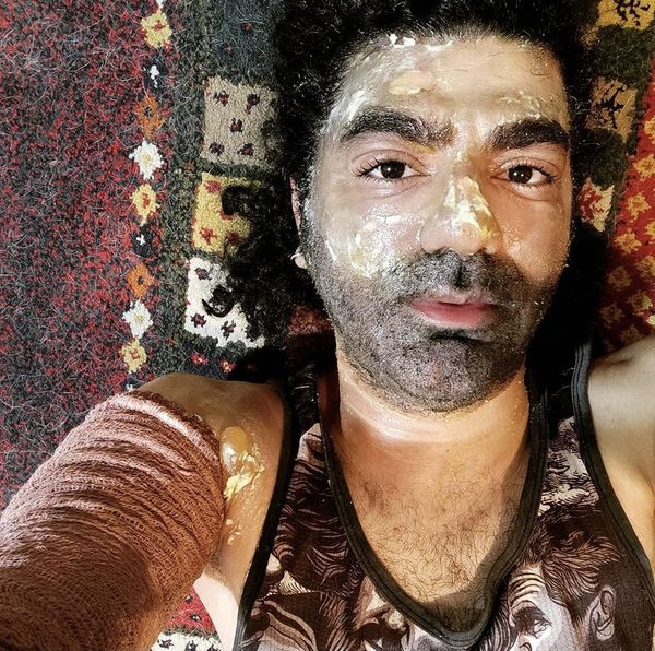 صورت بازیگر مشهور سوخت + عکس