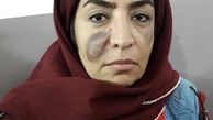 گریم‌متفاوت ‌ساناز سماواتی + عکس