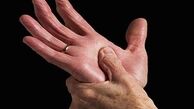 باکتری های ناسالم روده عامل ابتلا به آرتروز 