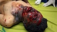 ۱۹ مصدوم چهارشنبه سوری در کل کشور