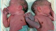 مورچه هایی که به نوزادن رها شده در کنار سطل زباله حمله کردند