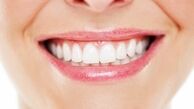 بهترین سفید کننده دندان خانگی چیست؟