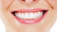 بهترین سفید کننده دندان خانگی چیست؟
