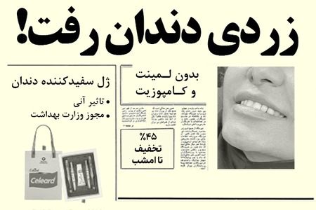 فرصت ویژه 45٪ تخفیف! دندان‌هاتو مثل کامپوزیت سفید کن!