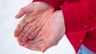 اگر سرما زده شدیم چه باید بکنیم ؟
