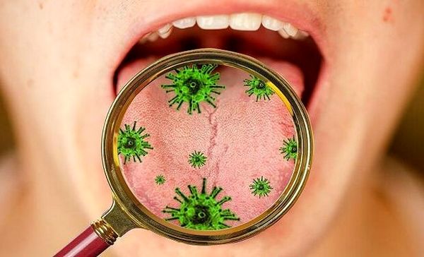 کرونا باعث زخم دهان و لثه ها می شود ؟