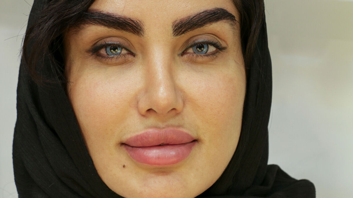 مراحل عمل تغییر رنگ چشم: از مشاوره تا نتیجه