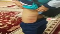 ماجرای تلخ تنبیه‌بدنی دانش‌آموز در مدرسه