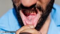 تصویری جالب از تتوی یک خلافکار در جایی که فکرش را نمی کنید !