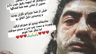 بازیگر جوان کشور دچار سانحه آتش سوزی شد + عکس