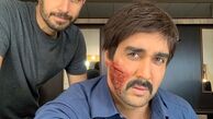 پوریا پورسرخ با صورتی کتک خورده و زخمی+عکس