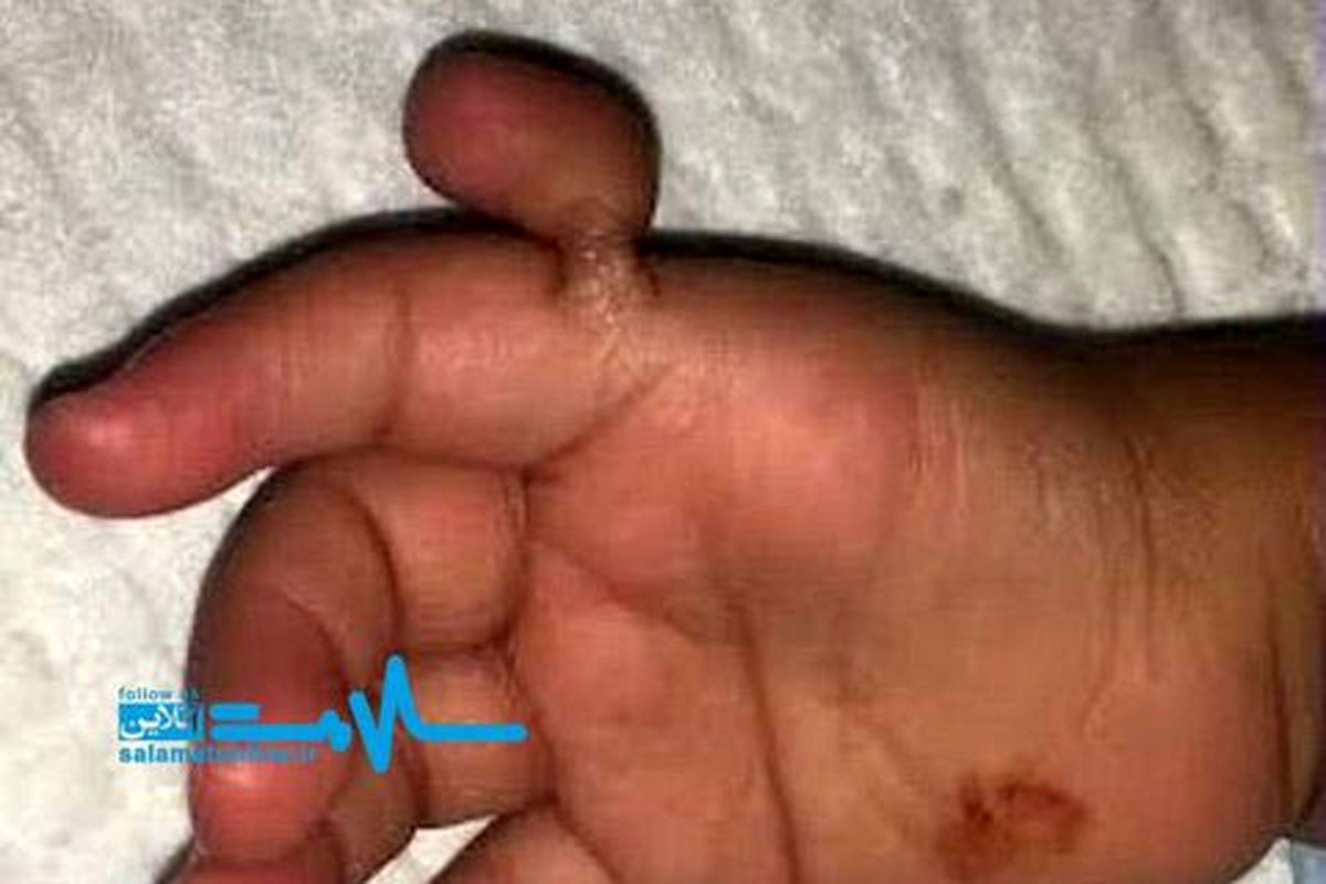 عمل جراحی شگفت آور روی دختر بچه 2 ساله!/عکس