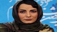 قیافه جالب «سمیرا حسن‌پور» در دندانپزشکی
