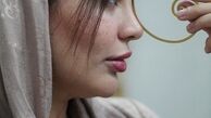 عمل بینی با استفاده از فیبوناچی