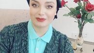تغییر ظاهر صبا راد پس از بازگشتش از ترکیه + عکس