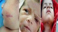 12 پرونده جنجالی اشتباهات پزشکی در ایران 