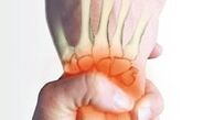 چگونه به آرتروز مبتلا نشویم