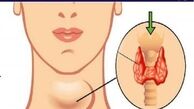 ۱۰ نشانه کار نکردن غده تیروئید + توضیحات