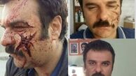 گریم‌ دلخراش آقای بازیگر + عکس