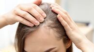 آیا شامپوهای ضد ریزش واقعاً از ریزش مو جلوگیری می کنند؟