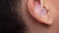 پوشش هزینه سمعک برای نوزادان و کودکان توسط بیمه سلامت