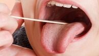 چگونه بوی بد دهان را با طب سنتی درمان کنیم؟