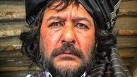 صورت زخمی شده امیرحسین صدیق + عکس