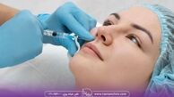 مزوژل پروفایلو چیست و چه مزایایی برای پوست دارد؟