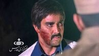 صورت زخمی و خونی پوریا پورسرخ + عکس
