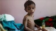 سازمان ملل: ۲۲ میلیون یمنی کمک نیاز دارند