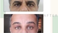 10 سال جوانتر شو !