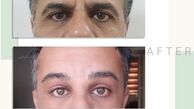 10 سال جوانتر شو !