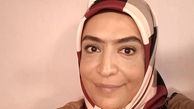 ساناز سماواتی با ابروی پیوندی + عکس