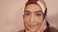 ساناز سماواتی با ابروی پیوندی + عکس