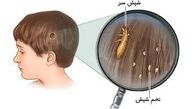 دلایل شیوع بیماری شپش در کودکان