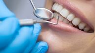 رفتن به دندانپزشکی در این ایام خطرناک است؟