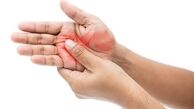 دلایل بی حسی و سوزش در بدن