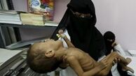  هشدار سازمان ملل درباره عدم امنیت غذایی در یمن