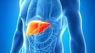 با این روش های ساده با با کبد چرب خداحافظی کنید