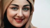 «ویدا جوان» و این همه تغییر! /عکس