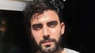 بازیگر چشم روشن سریال مانکن در قاب پنجره + عکس