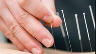 ژاپن بزرگترین صادرکننده سوزن به ایران + جدول