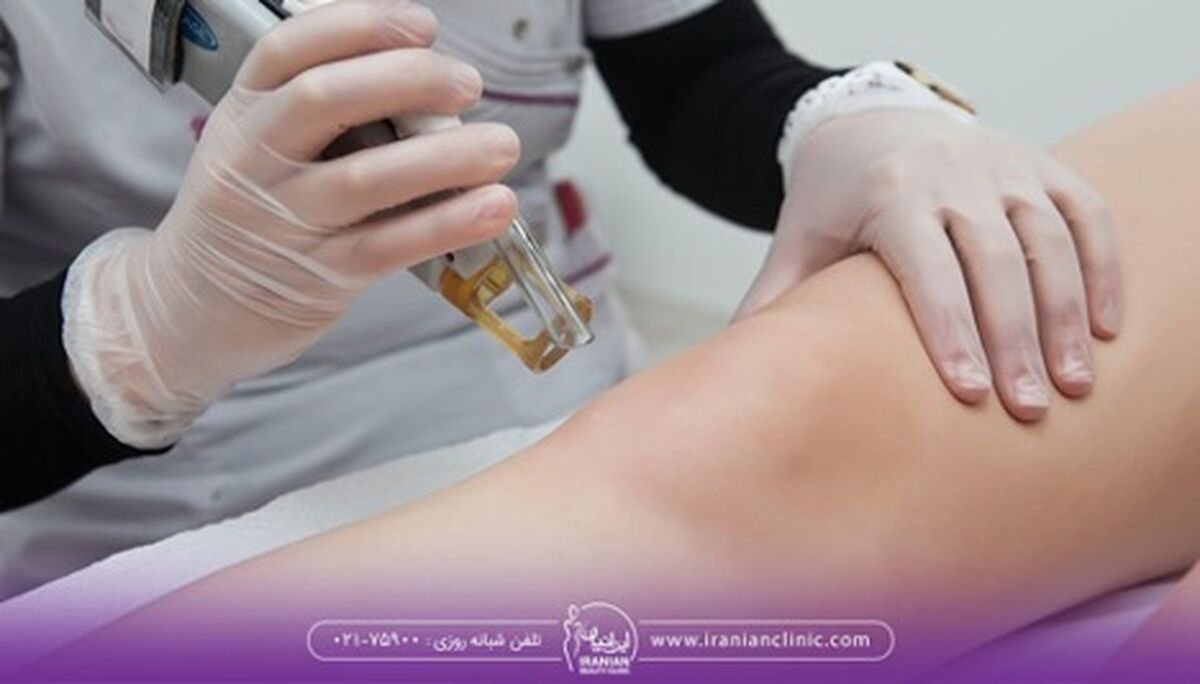 چرا از لیزر موهای زائد نتیجه نمی گیریم؟