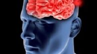 از بیماری «آنوریسم» چه می‌دانید؟