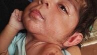 کودک آزاری به سبک گازگرفتن